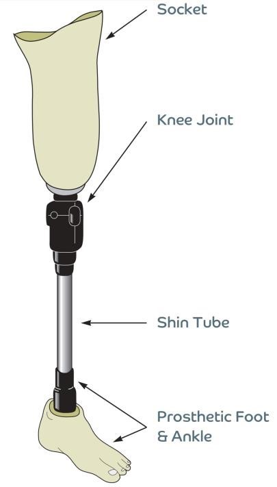 What are the parts of a prosthesis? - Bedfordshire Hospitals NHS Trust