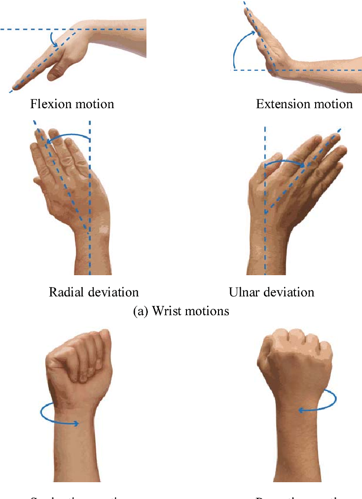 H12A - Carpal bone Avulsion Fracture - Bedfordshire Hospitals NHS Trust