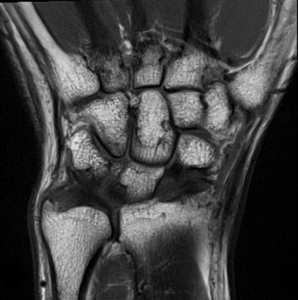 Scan of a Musculoskeletal System using an MRI machine