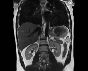 Scan of a abdominal cavity using an MRI machine