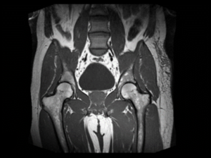 Scan of a pelvis using an MRI machine