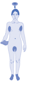 Apply lotion all over hair and body, diagram indicating to pay special attention to armpits, groin and feet