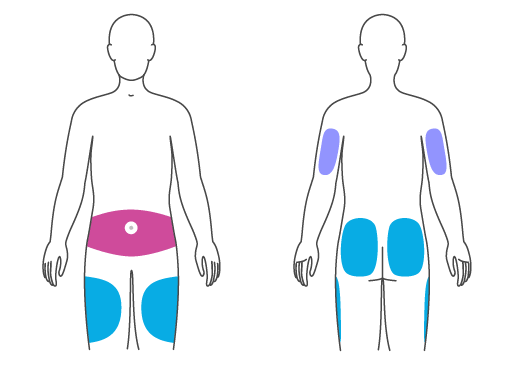 Locations where insulin can be injected