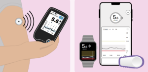 Continuous glucose monitors (CGM) diagram