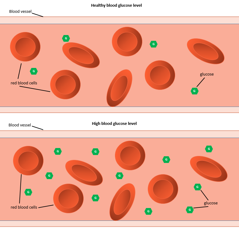 Healthy blood glucose - high blood glucose